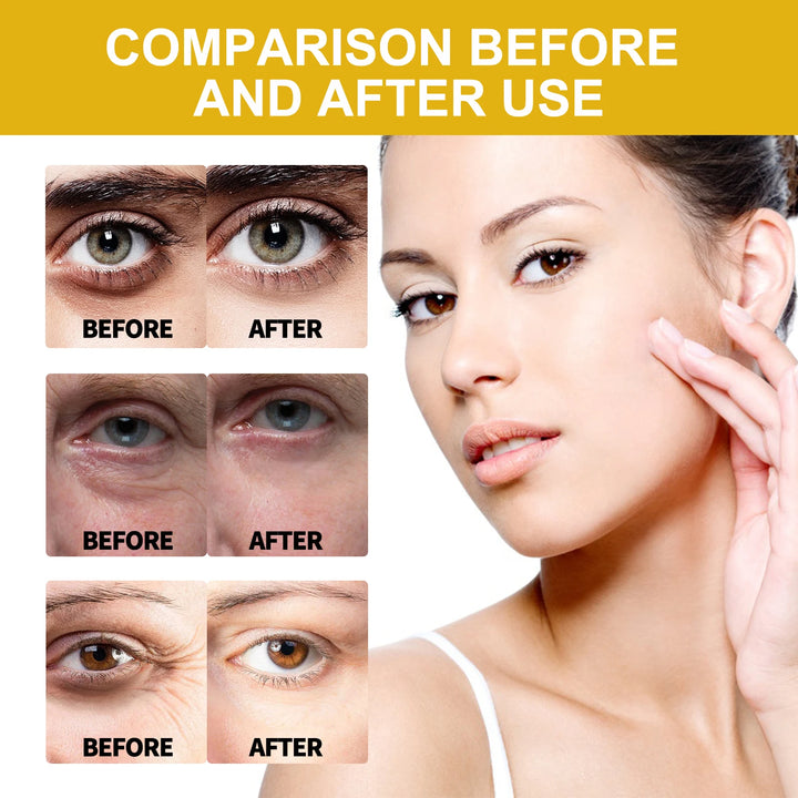 Absorbs Easily Wrinkle-resisting Essence Anti-aging Brighten Fade Fine Lines Strengthen Firm Face Neck Skin Venom Peptide Serum